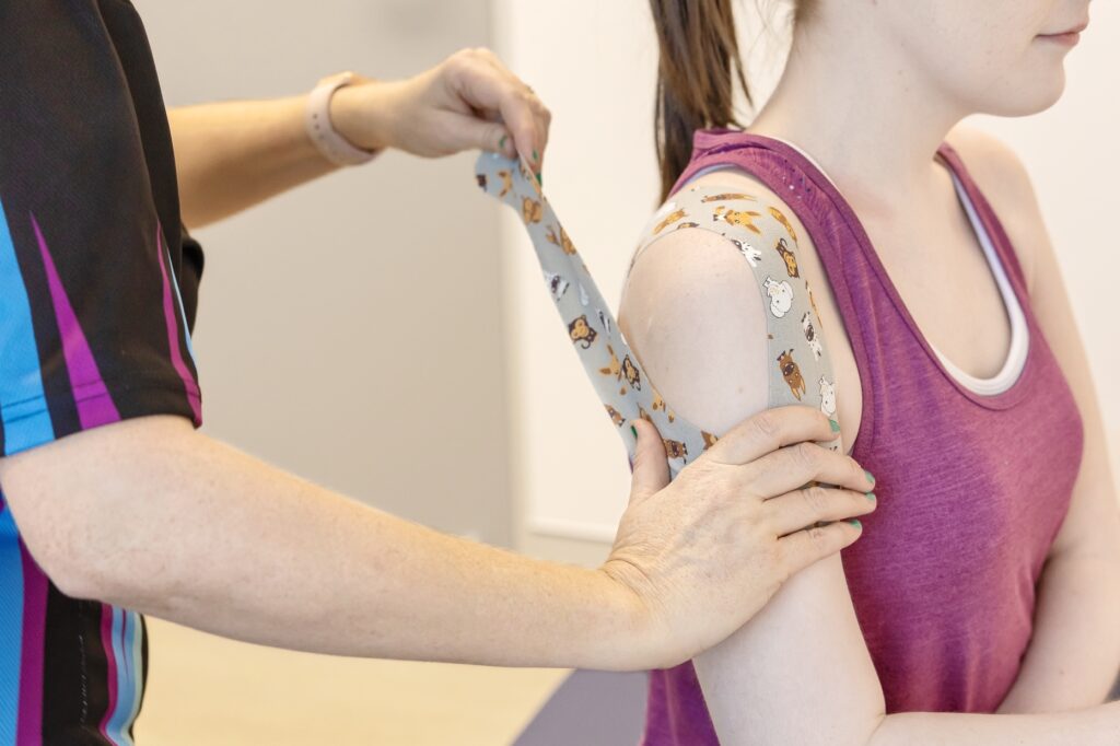 Physiotherapist applying animal-print kinesiology tape to a woman’s shoulder for joint support in hypermobility.