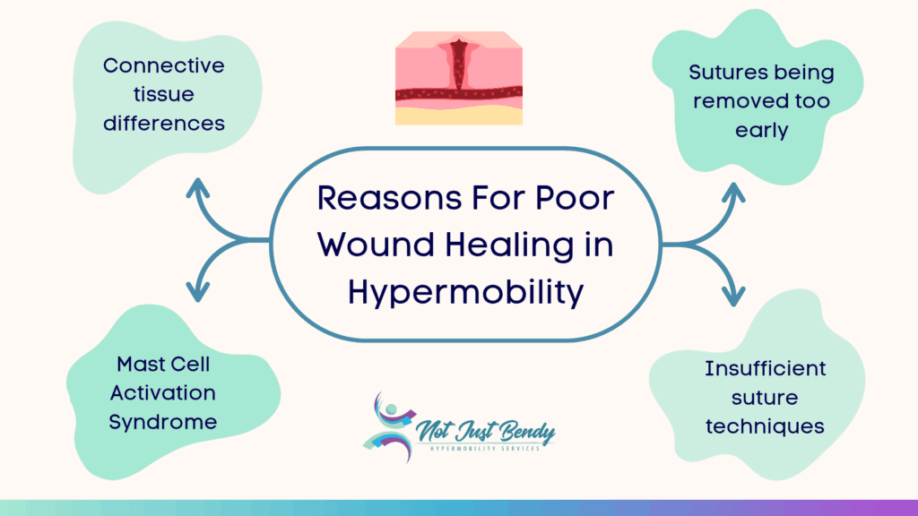Reasons for poor wound healing in hypermobility, pointing to;
- Connective tissues differences
- Sutures being removed too early
- Mast Cell Activation Syndrome
- Insufficient suture techniques